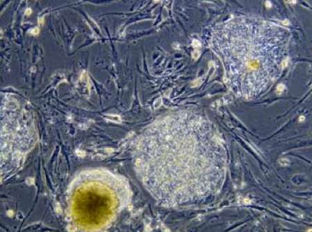 Sobre las células regenerativas - Dr. Juan Monreal