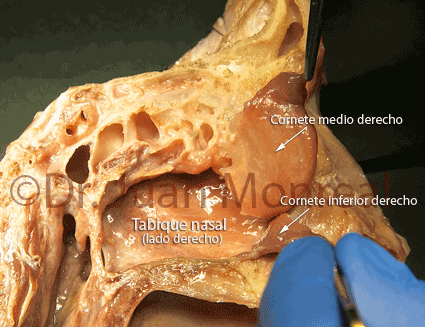 Anatomia interna de la nariz, tabique y cornetes