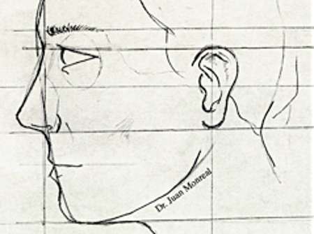 Bases estetica nasal y facial - Dr. Juan Monreal
