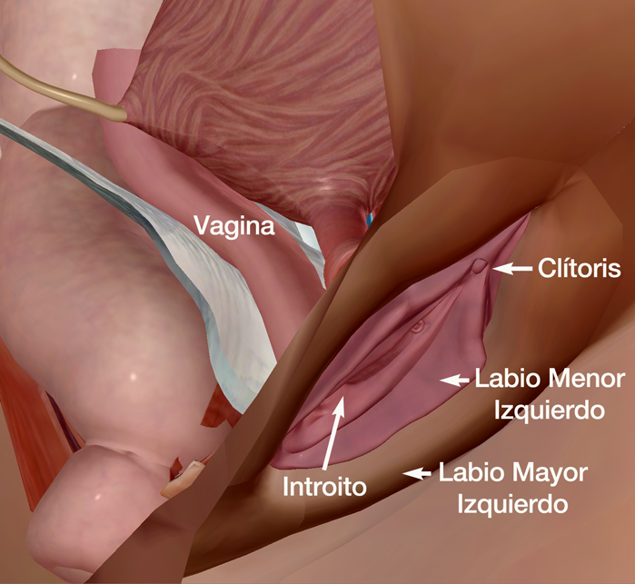 Esquema genital femenino. Vaginoplastia. Dr. Juan Monreal