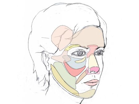 Modelado de mentón y mandíbula con injertos de grasa - Cara Jóven - Dr. Juan Monreal