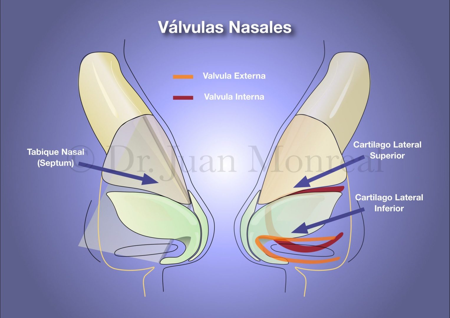 Importancia de las válvulas nasales durante una rinoplastia