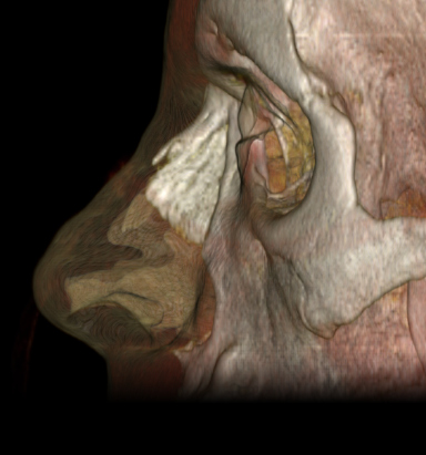 analisis-estudio-TAC-dr-juan-monreal-01-385x411