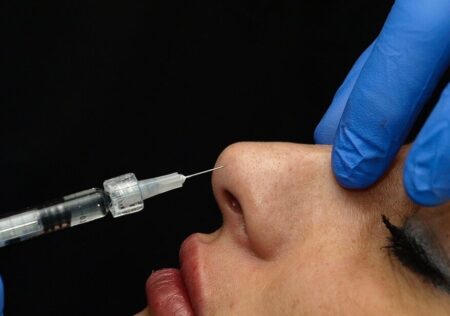 Rinoplastia en pacientes con rinomodelación o con implantes nasales